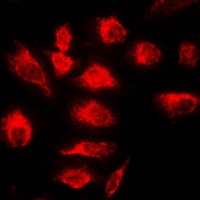 Anti-A20 Antibody