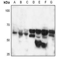 CD120b Antibody
