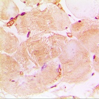 Anti-cTnI Antibody