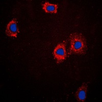 Anti-cTnI Antibody