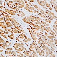 Anti-cTnT Antibody