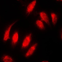 Topoisomerase 2 alpha Antibody [KO/KD Validated]