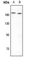Topoisomerase 2 beta Antibody