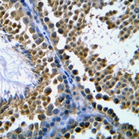 Anti-Topoisomerase 2 beta Antibody