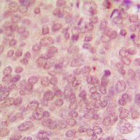 Anti-p53 (Phospho-S315) Antibody
