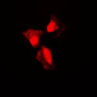 Anti-p53 (Phospho-S315) Antibody