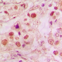 p53 Antibody