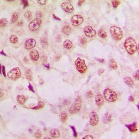p53 Antibody