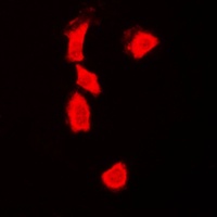 p53 Antibody