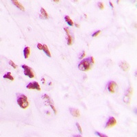p73 (Phospho-Y99) Antibody
