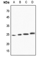 TCTP Antibody