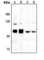GRP94 Rabbit Polyclonal Antibody