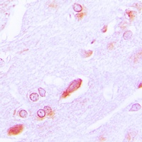 Anti-GRP94 Antibody