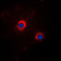 Anti-GRP94 Antibody