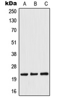 TWIST Rabbit Polyclonal Antibody