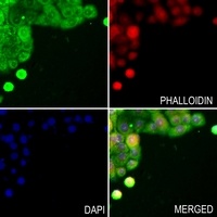 Anti-TWIST Antibody
