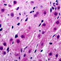 Anti-Tyrosinase Antibody