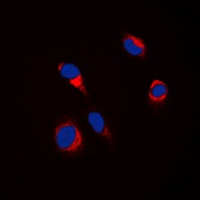 TYR antibody