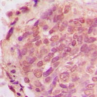 Anti-Ub Antibody