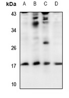 UBE2A/B Antibody