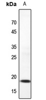 UBC9 Rabbit Polyclonal Antibody