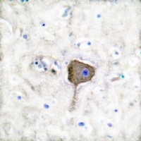 Anti-PGP9.5 Antibody