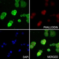 Anti-UDG Antibody