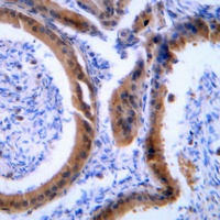 Anti-VASP Antibody