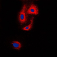 Anti-VASP Antibody