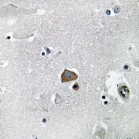 Anti-VAV2 Antibody