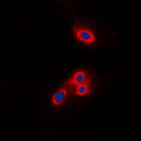 Anti-VAV2 Antibody