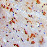 Anti-VCP Antibody