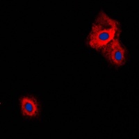 Anti-VGF Antibody
