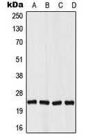 Von Hippel Lindau Rabbit Polyclonal Antibody