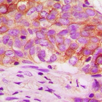 Ezrin (Phospho-T567) Antibody