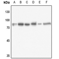 Ezrin Rabbit Polyclonal Antibody