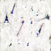 Ezrin Rabbit Polyclonal Antibody
