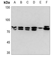 Ezrin Rabbit Polyclonal Antibody