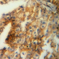 Ezrin Rabbit Polyclonal Antibody