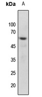 Vimentin (Phospho-S56) Antibody