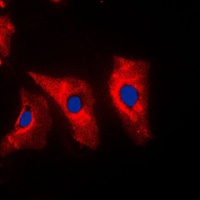 Vimentin Antibody