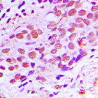 Anti-XPA Antibody