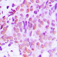Anti-XRCC1 Antibody