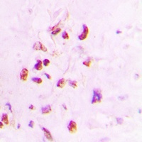 Anti-XRCC3 Antibody
