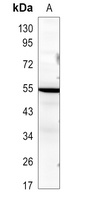 XRCC4 Rabbit Polyclonal Antibody