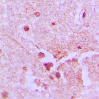 Ku80 Antibody