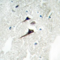 Anti-14-3-3 epsilon Antibody