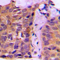 Anti-14-3-3 zeta Antibody