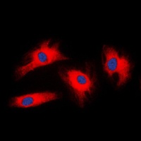 Anti-14-3-3 zeta Antibody