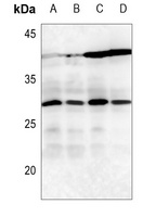 14-3-3 zeta Antibody